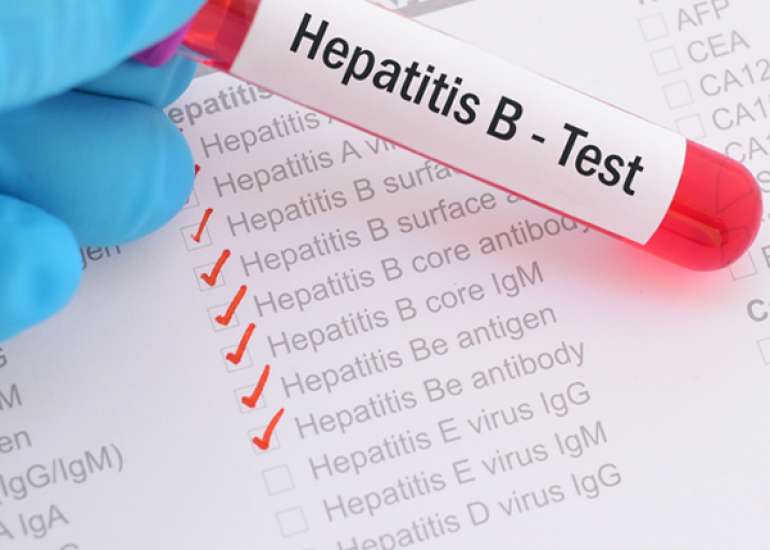 Hepatitis B and its treatment