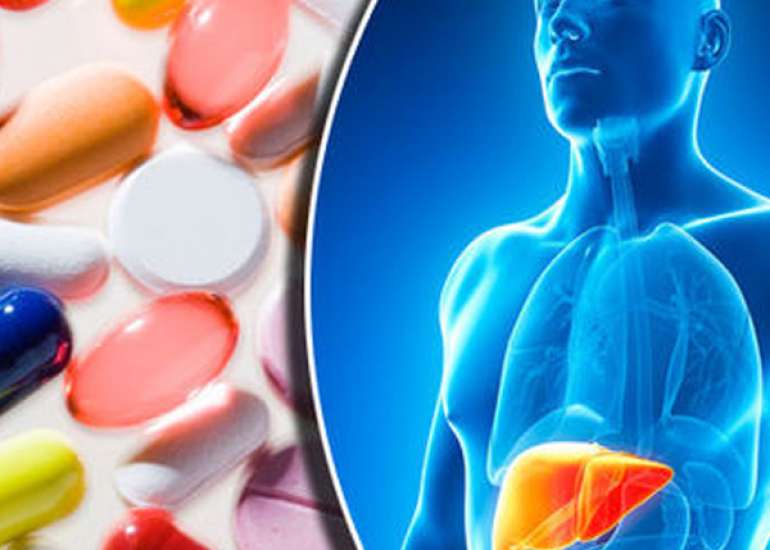 Management of Drug Induced Liver Injury