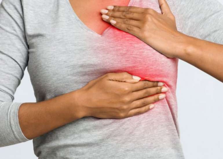 Fertility preservation in women with breast cancer