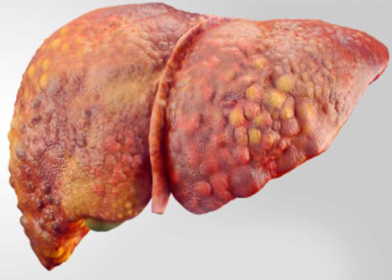 For an executive health checkup, what is the preferred liver function test?