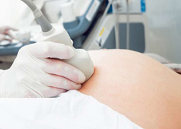 Function and Safety of SlowflowHD Ultrasound Doppler in Obstetrics