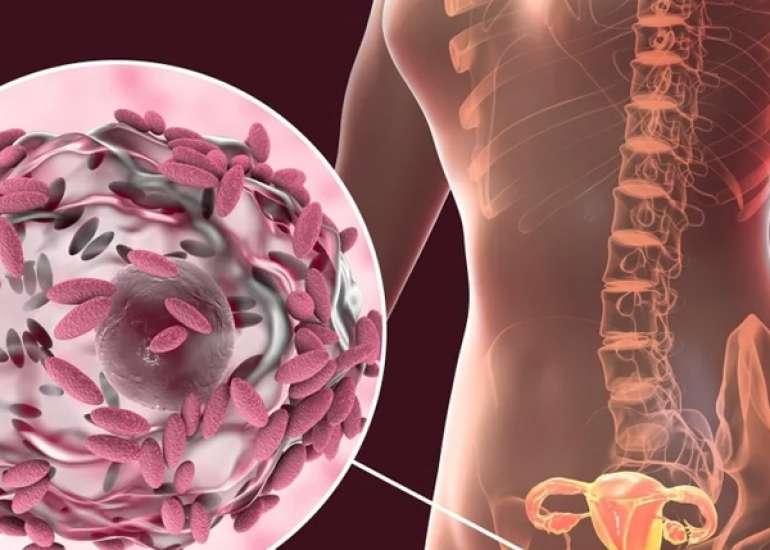 H2O2-Producing Lactobacilli Associated With Lower Levels of Vaginal Interleukin-1β, Independent of Bacterial Vaginosis