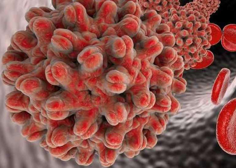 Hepatitis B In Special Population