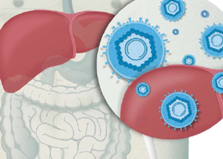 Hepatitis in Special Population