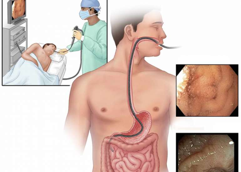 How to know if you have Celiac Disease?