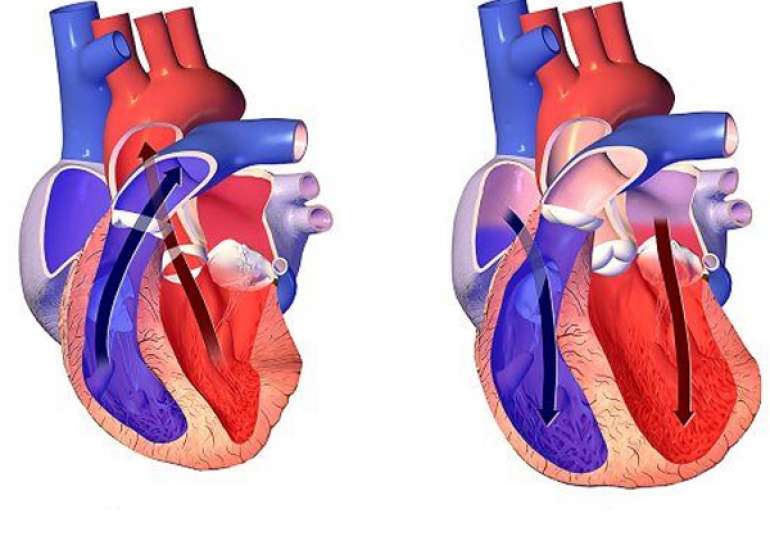 How can we differentiate Diastolic Dysfunction & Diastolic Failure?