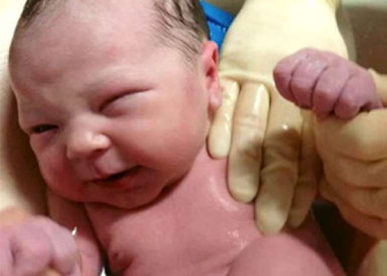 How frequently should the children with hole in heart be followed up?