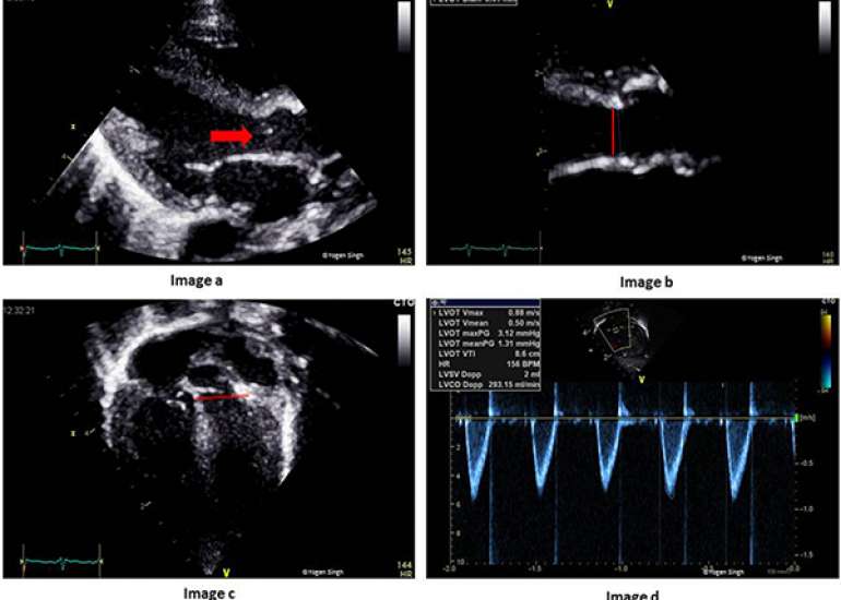 How reliable are echo-guided hemodynamic parameters?