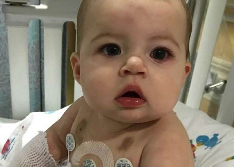 Hyperdiploidy: the longest, most widely prevalent, and most mysterious form of acute lymphoblastic leukemia in children