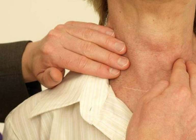 Hypothyroidism-induced spontaneous ovarian hyperstimulation syndrome