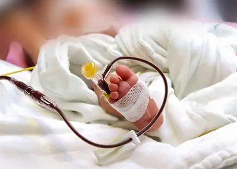 Impact of Reducing Early Blood Sampling on Transfusion Needs in Extremely Premature Neonates