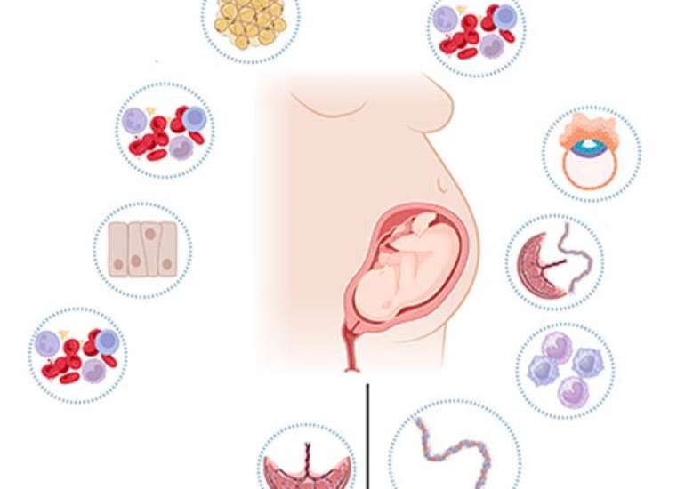 Influence of maternal hemodynamics on treatment for gestational diabetes