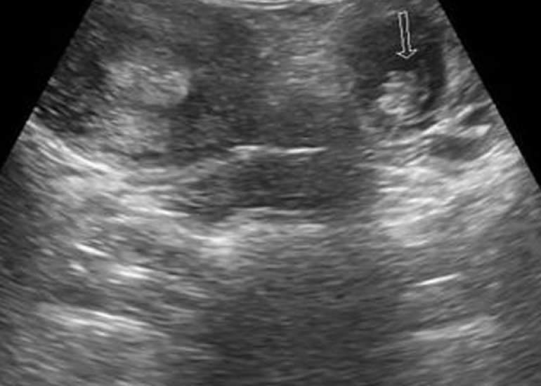 Interventional Radiology in Gynecology and Obstetrics Practice