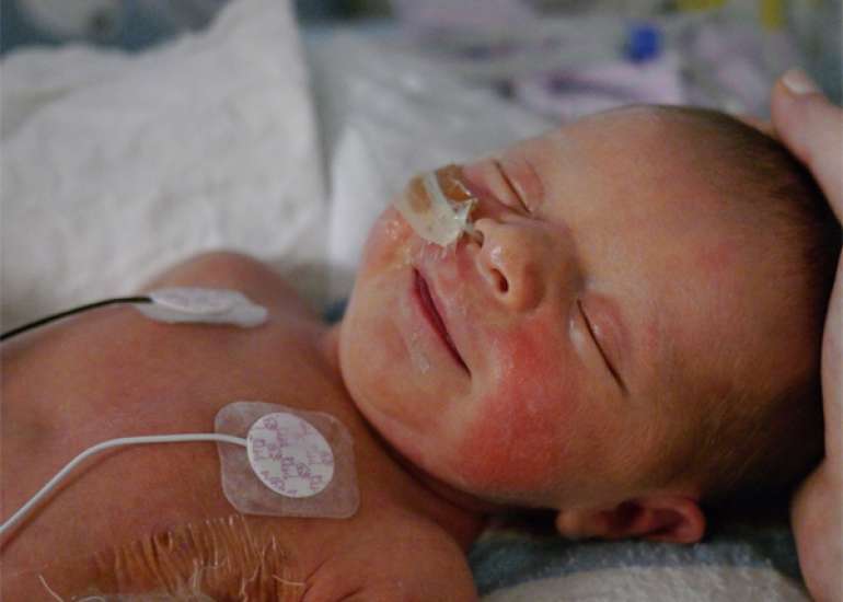 Invasive Bacterial Infections incidence rates in Preterm Infants