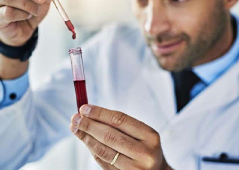 Is a cholesterol value reliable, does it vary from lab to lab?