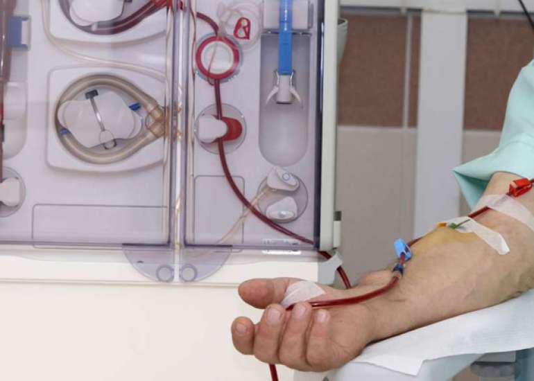Is dialysis the only option if I develop ESRD?