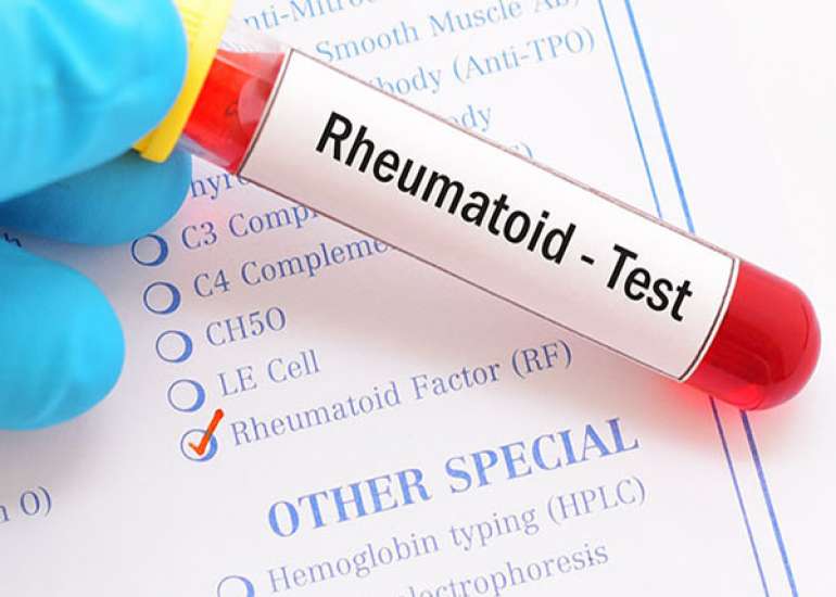 Is Rheumatoid factor a diagnostic test for rheumatoid arthritis?