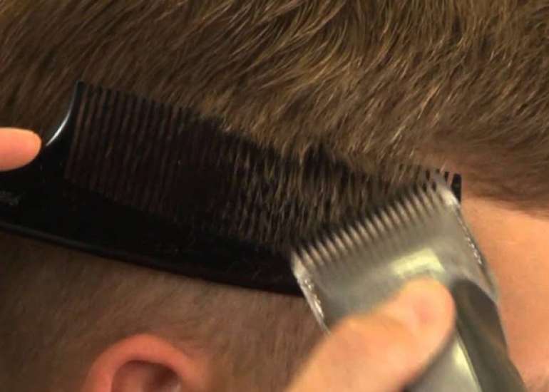 Is it necessary to cut hair with a razor before any surgery?