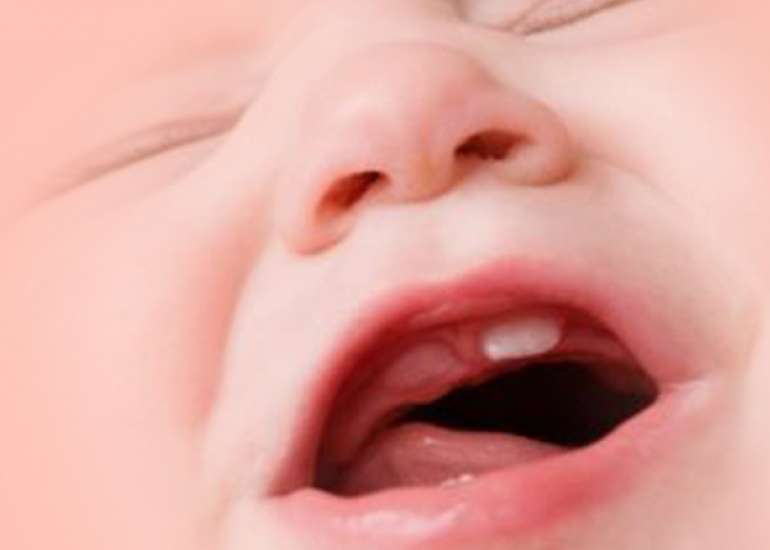 Is it true that breathing through the mouth can cause dry mouth in my baby?