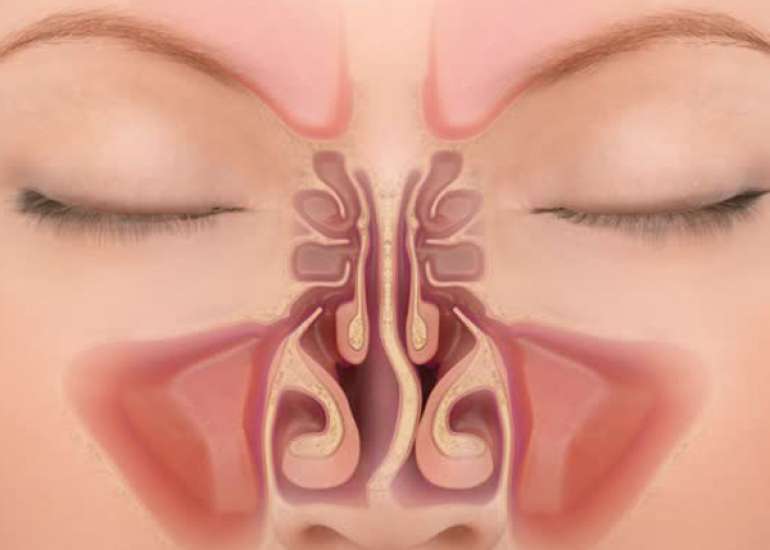 Is nasal blockage a common problem?