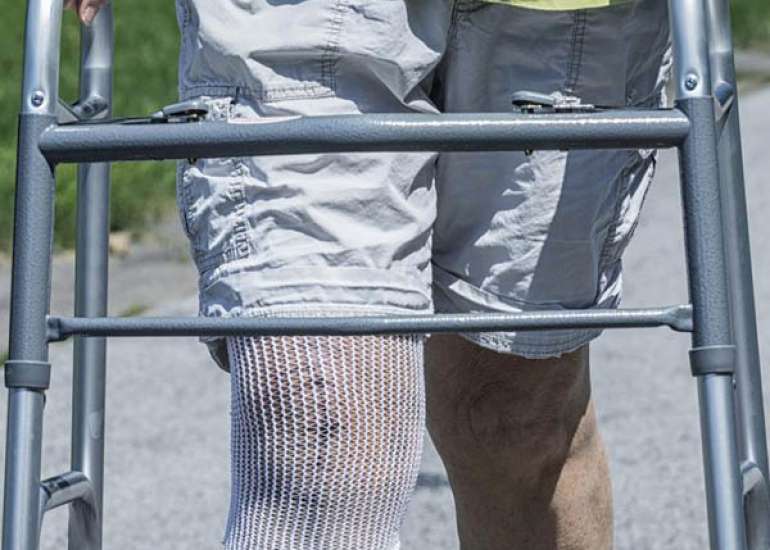 Is there a need for walker, crutches, or cane or other help after knee replacement surgery?