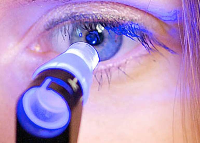 Is there any screening test for diagnosis of glaucoma?