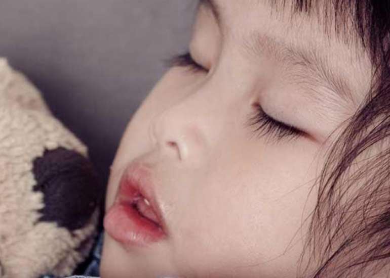 Is there a relation between mouth breathing and an elongated facial feature?