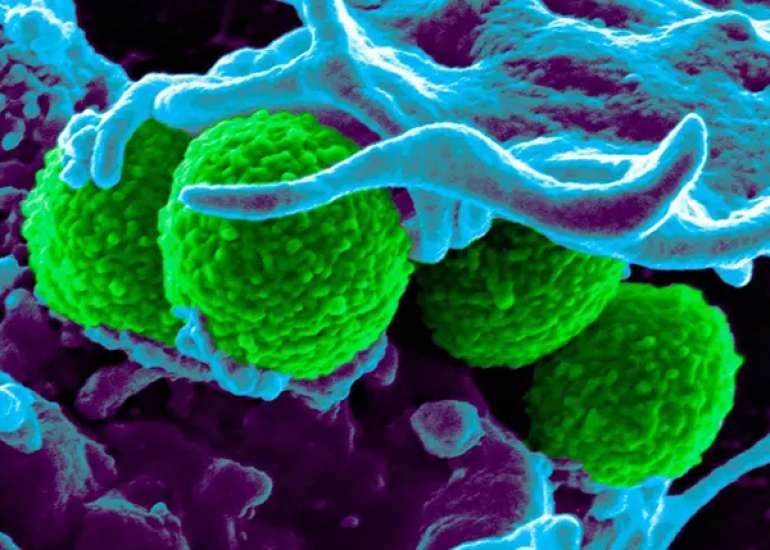 It is a common practice to give a combination of two antibiotics. Is this correct?