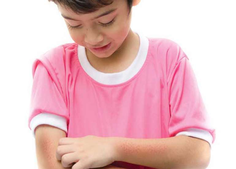 It seems that more and more kids have allergies these days. Why is that?