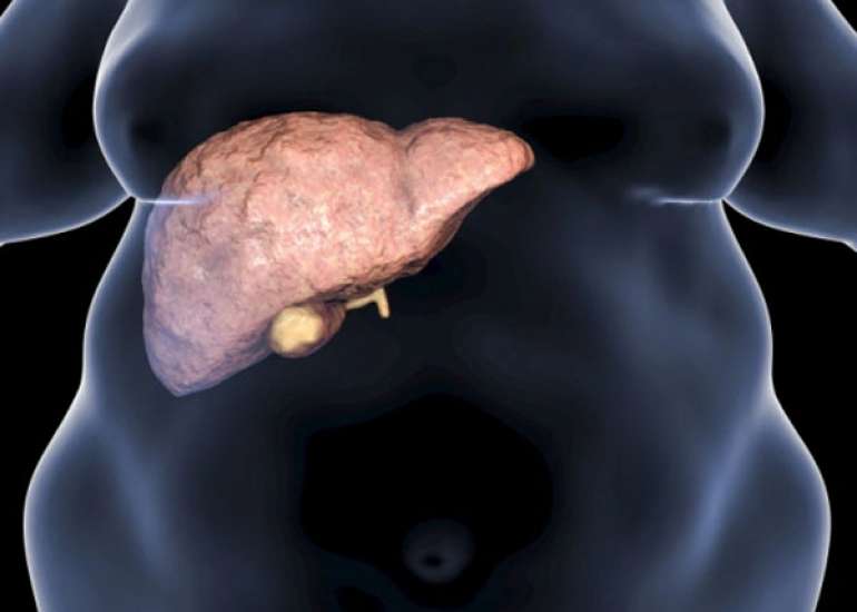 Key Findings in Liver Diseases for Practitioners