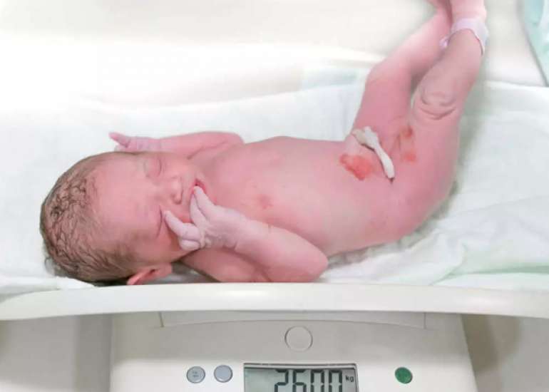 Kangaroo Mother Care Transport Prevents Moderate Hypothermia in Low Birth Weight Babies during Transportation to Home Following Discharge