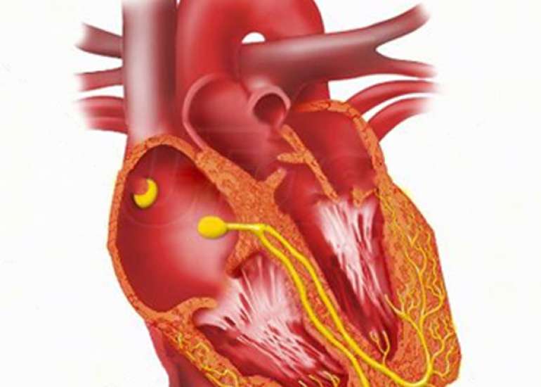LBB vs RBB: What will you ignore in an ECG?