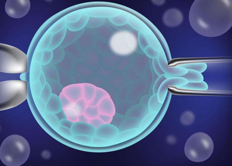 Live Birth with or without Preimplantation Genetic Testing for Aneuploidy