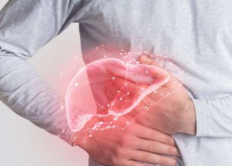 Liver Cysts & Associated Complications