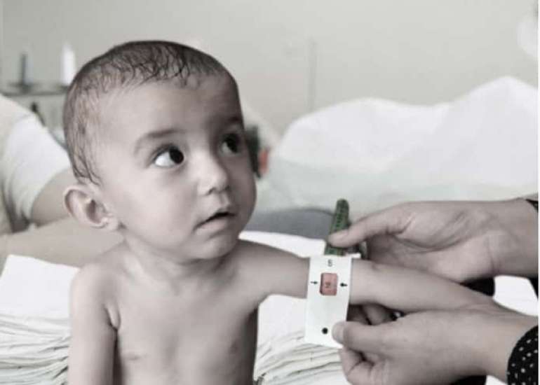 Longitudinal Development of Health-related Quality of Life and Fatigue in Children on Home Parenteral Nutrition