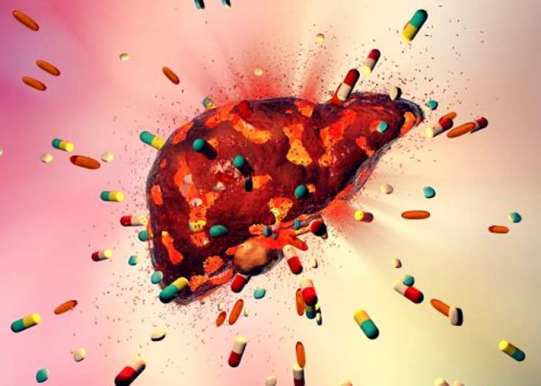 Management of Antitubercular Drug Induced Hepatoxicity