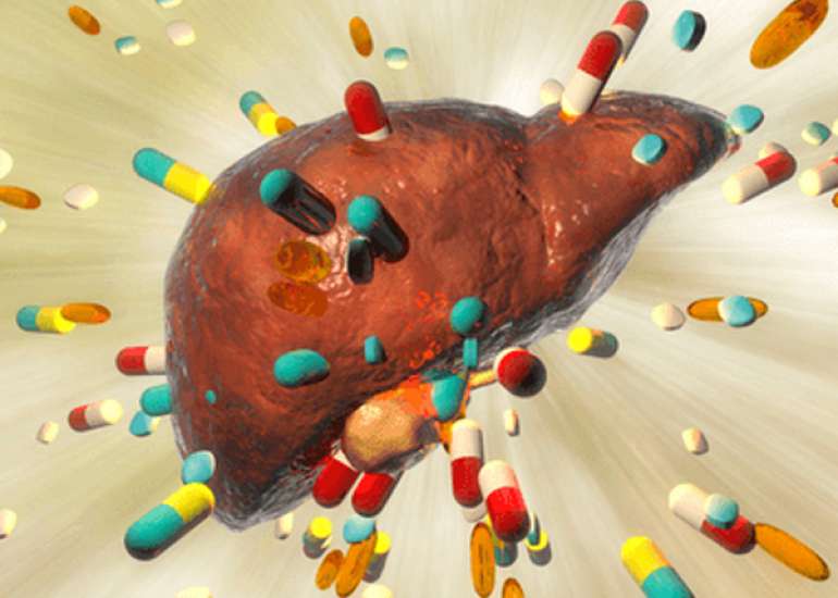 Management of Drug-induced Liver Injury