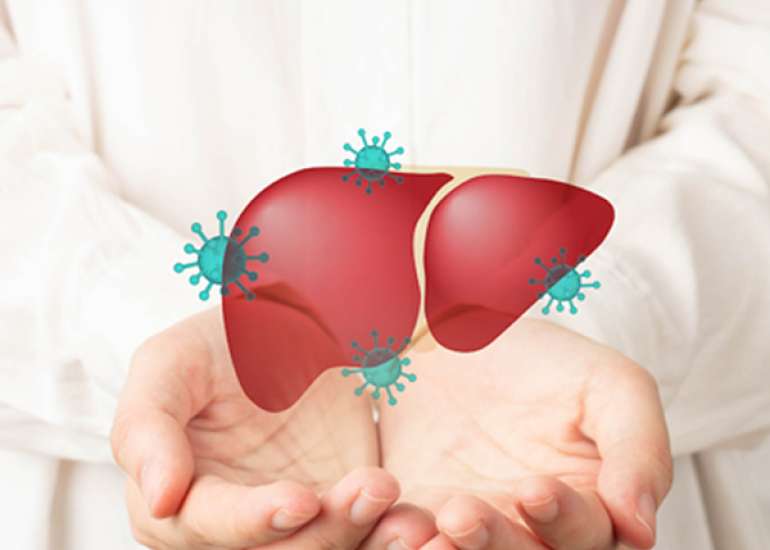 Management of Hepatitis Options and Challenges