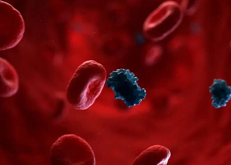 Metabolic Syndrome & Its Management