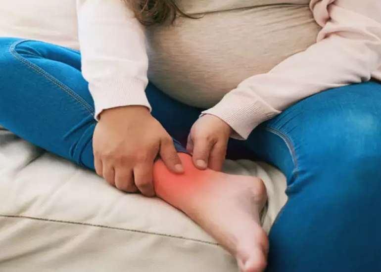 Modified Buerger-Allen Exercises can Alleviate Pedal Edema In Late Pregnancy