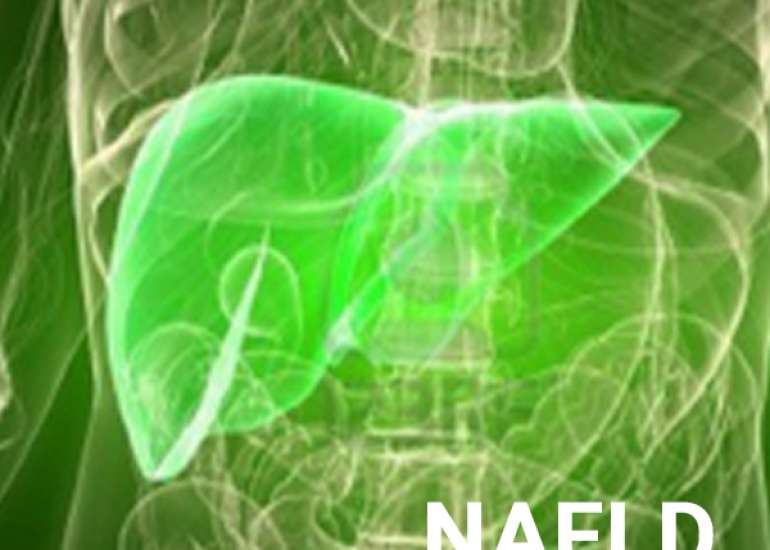 NAFLD: A Multisystem Disease