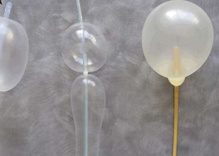 NASG and balloon tamponade improve outcomes in obstetrics hemorrhage cases