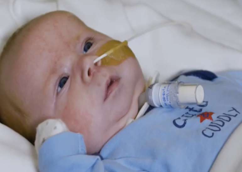 National Cohort Study of Health Care Resource Use after Pediatric Tracheostomy