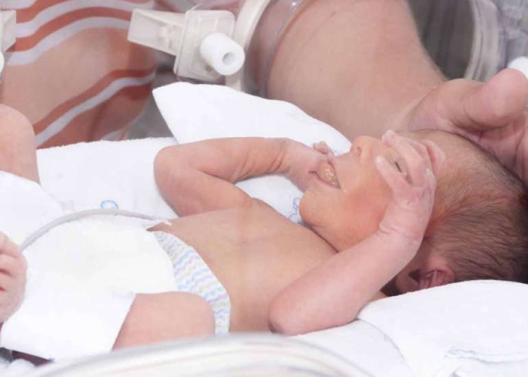 Neonatal Morbidities in Infants Born Late Preterm at 35-36 Weeks of Gestation