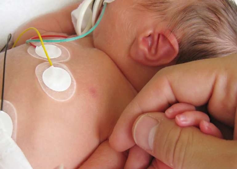 Neonatal Microbiome, Intestinal Inflammation, and Necrotizing Enterocolitis