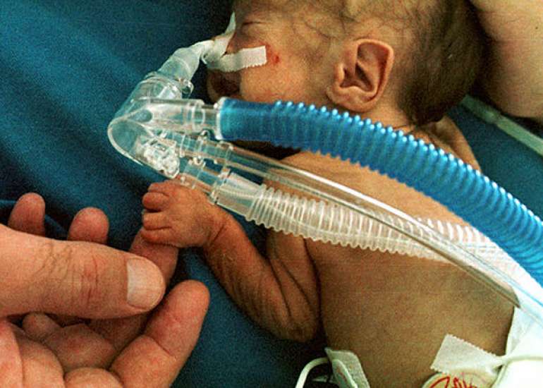 Neonatal Hemoglobin Levels in Preterm Infants Are Associated with Early Neurological Functioning