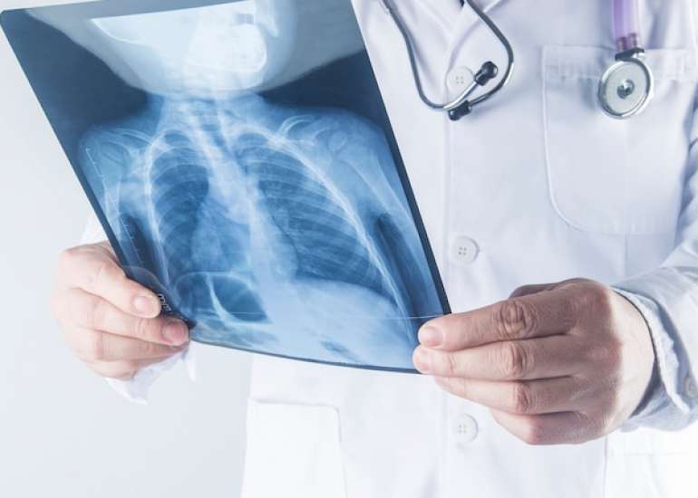 एक्स-रे क्या है?| X-ray in Hindi