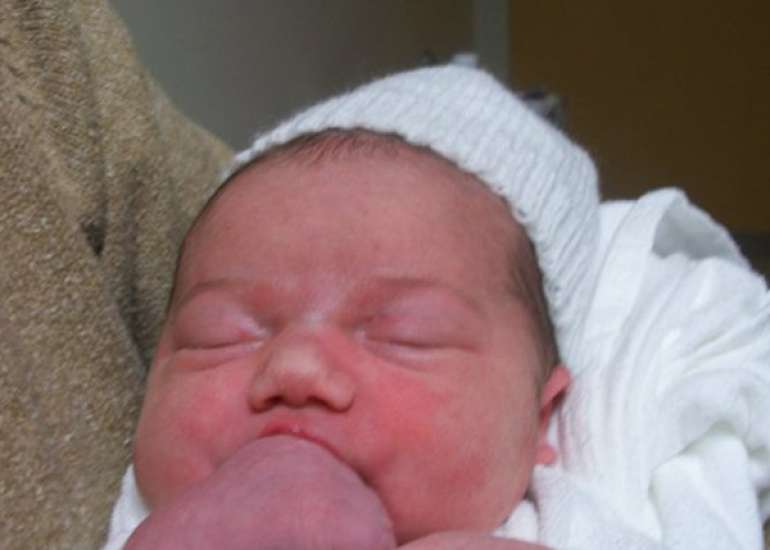 Newborn infant skin gene expression: Remarkable differences versus adults