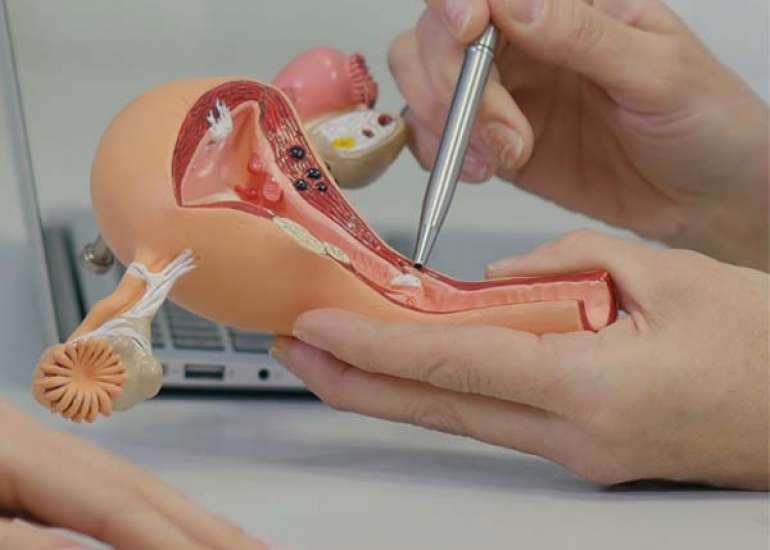 Novel Contrast Medium for Tubal Assessment in Infertility