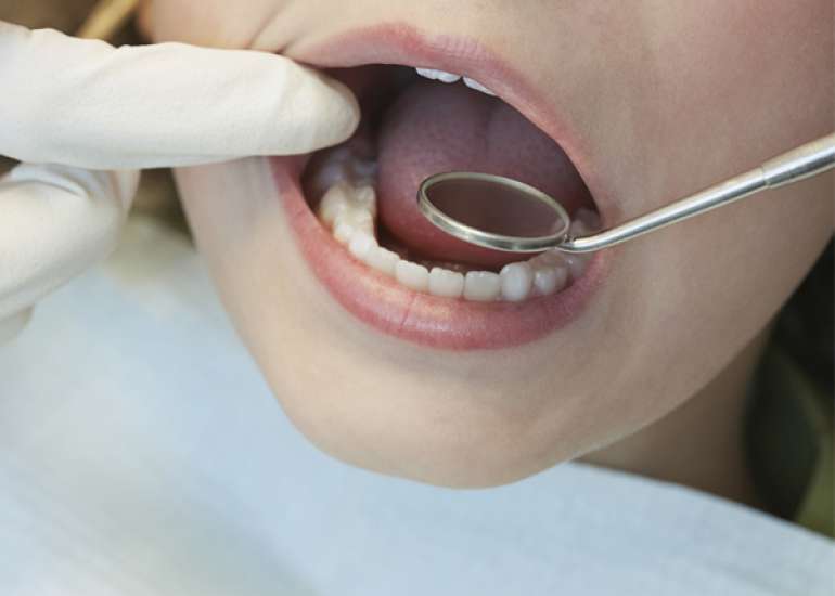 Oral Cancer: Symptoms & Treatment